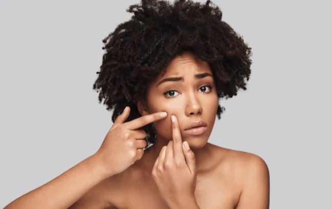 does lack of sleep cause acne